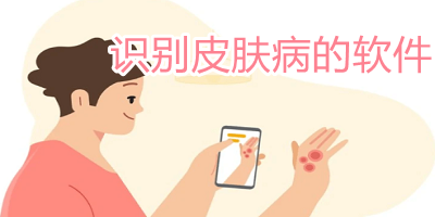 识别皮肤病的软件