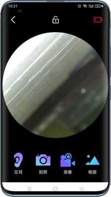 可视采耳仪APP3