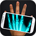 Xray